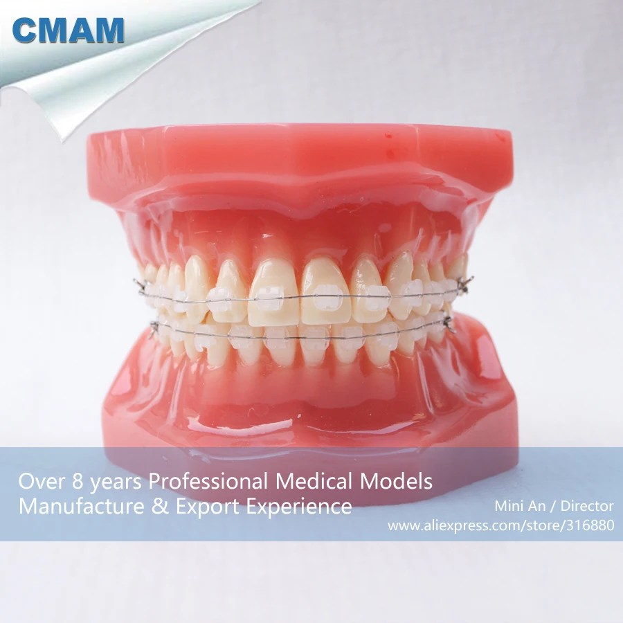 

CMAM-DH206-3 Ortho Ceramic Bracket Tooth Jaw Model, ORT series Dental Model for Patient Communication