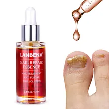 Горячее предложение! Распродажа! Лечение ногтей от грибка удаление грибка для ногтей эссенция для ногтей Отбеливание ног для кутикулы масло для ног Уход за ногами