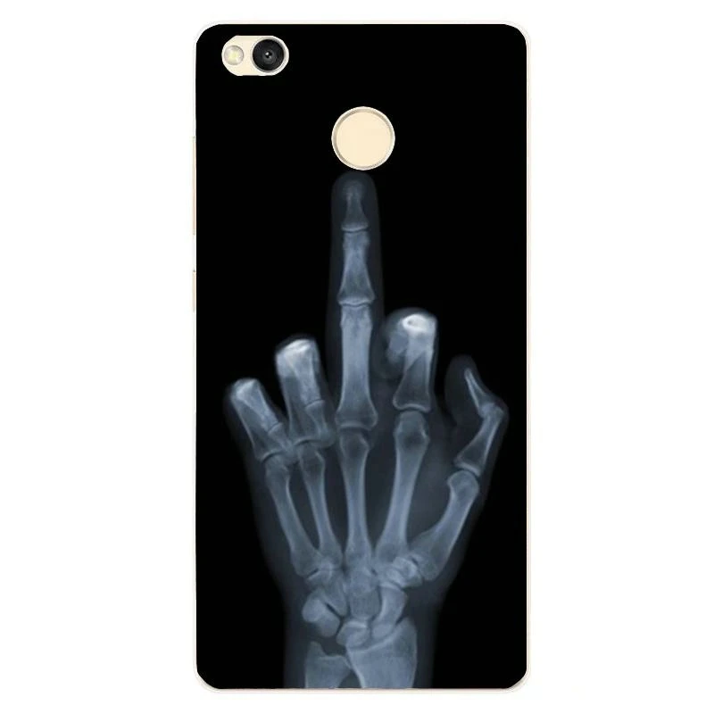 case05