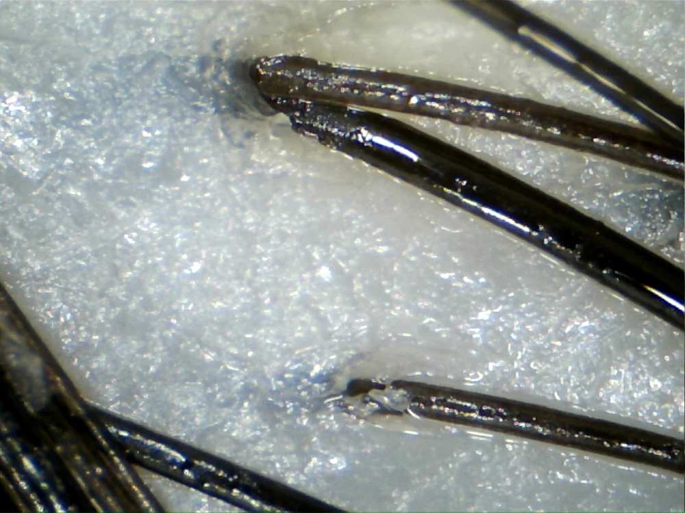 Promotion DHL free HOT SALE 5.0 MP High Resolution Digital CCD USB Hair Camera Hairscope Hair Analyzer Hair Scope Hair Diagnosis