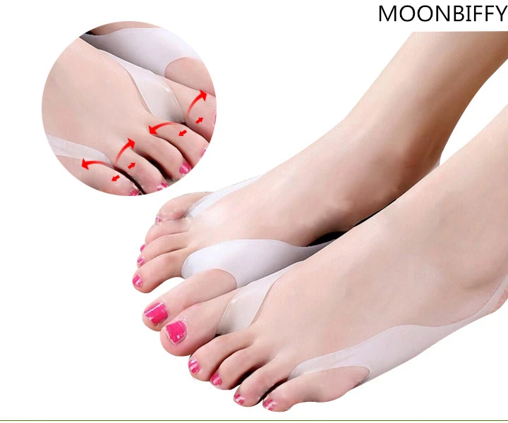 

Silicone Bone Medical Design Big Thumbs Extremity Fingers Toes Extremity Toes Foot Extrusion Flap Overthrumbers Orthopedic