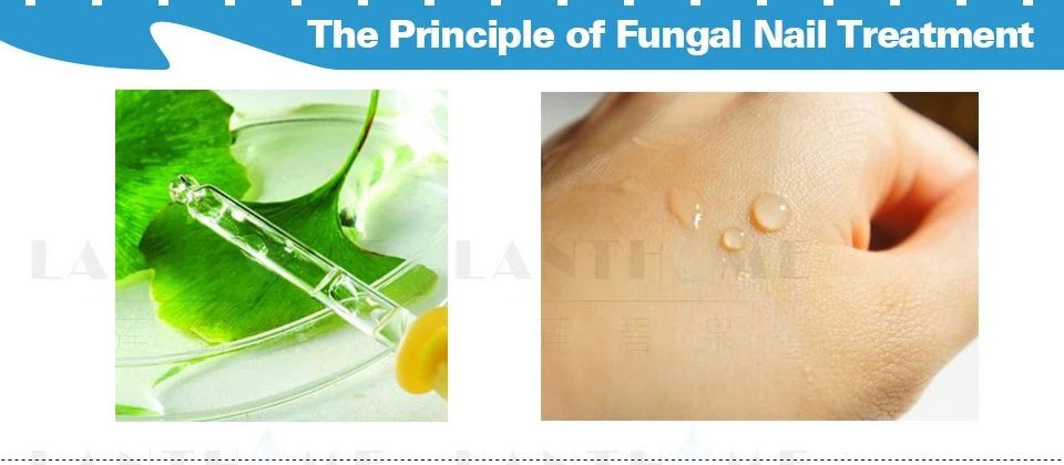 Дропшиппинг травяные грибковые ногти лечение ног удаление грибка ногтей гель Уход за ногами эссенция для ногтей Отбеливание ног яркий анти-инфекция