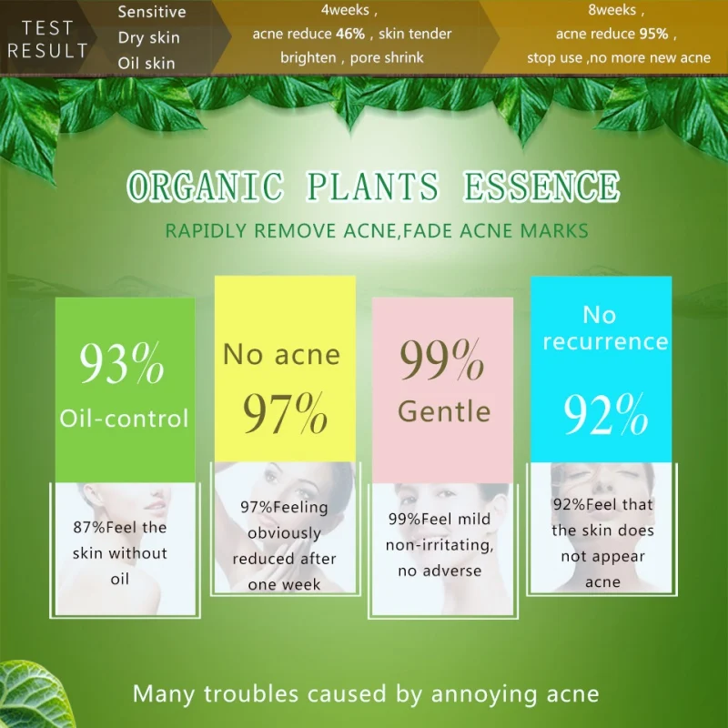 Уход за акне крем для лица растительная эссенция крем против акне удаление шрамов прыщей угрей увлажняющий отбеливающий усадочный уход за поры кожи
