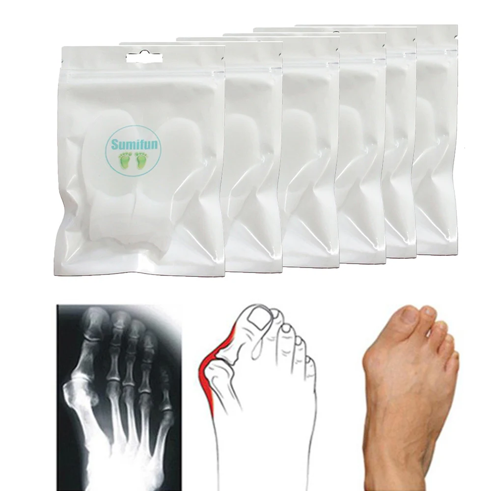

16Pcs Foot CareSilicone Gel Bunion Splint Hallux Valgus Deformity Orthotics Toe Separate Correction Foot Care Tool Z18708