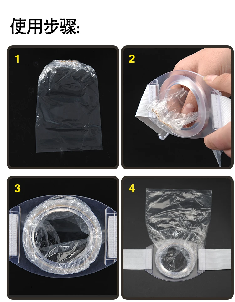 2 комплекта анального круга и 100 шт одноразовый анальный мешок поддельный анальный круг после мешок для колостомии после осуществления сумки