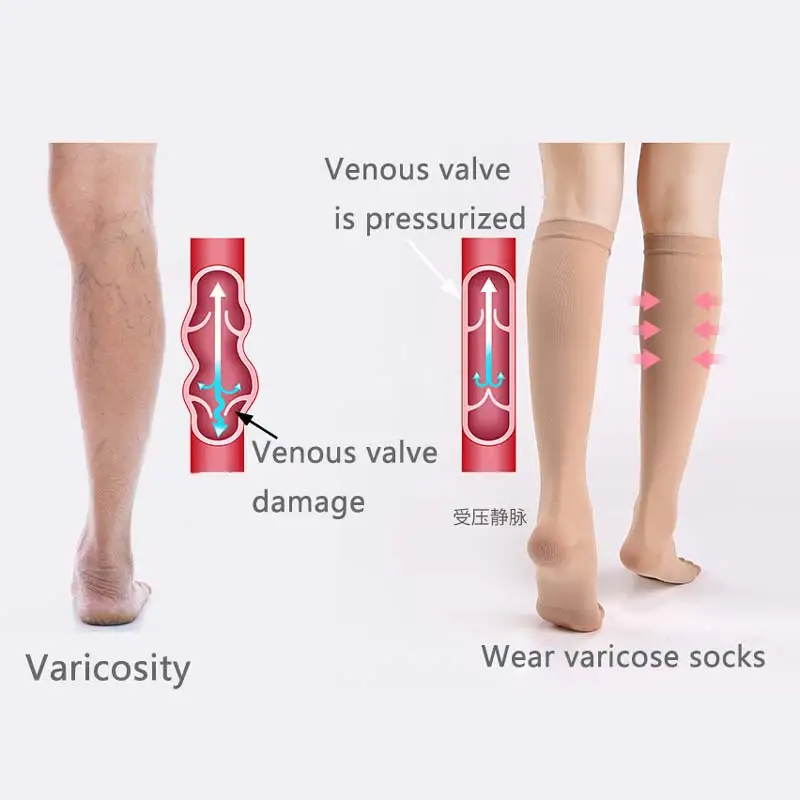 Медицинские компрессионные чулки варикозное расширение вен тонкие ноги Унисекс Чулки под давлением тонизирующие носки сосудистые забота о здоровье CCP049