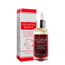 Травяные средства для лечения грибка ногтей, инструменты для ухода за ногтями, восстанавливающий крем для ухода за кожей, средство для ухода за ногтями, ногами, грибком, пальцами, маслом для кутикулы, инструменты для ухода за ногами