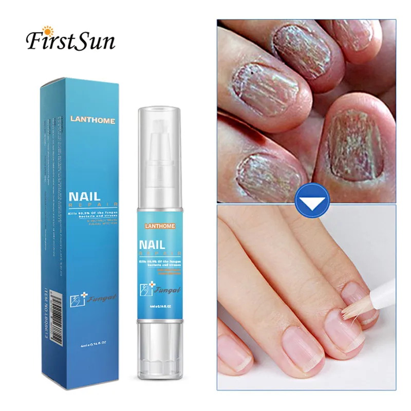 Herbal Antibacterial Nail Treatments Kit Essential Oil Herbal Extract Fungus Art nail Repair Foot Nail Care Improve Infection