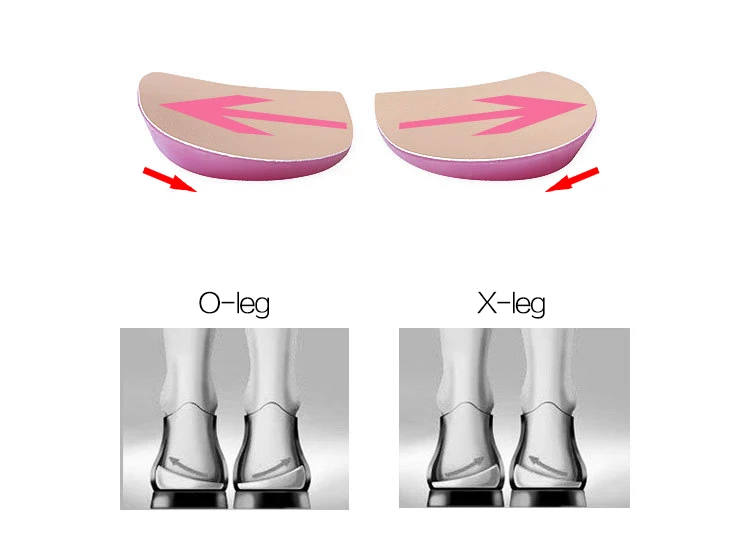 1 пара обувь унисекс Стельки для мужчин и женщин коррекция типа O/X коррекция ног ортопедический корректор плоскостопия обуви колодки пятки вставки стельки
