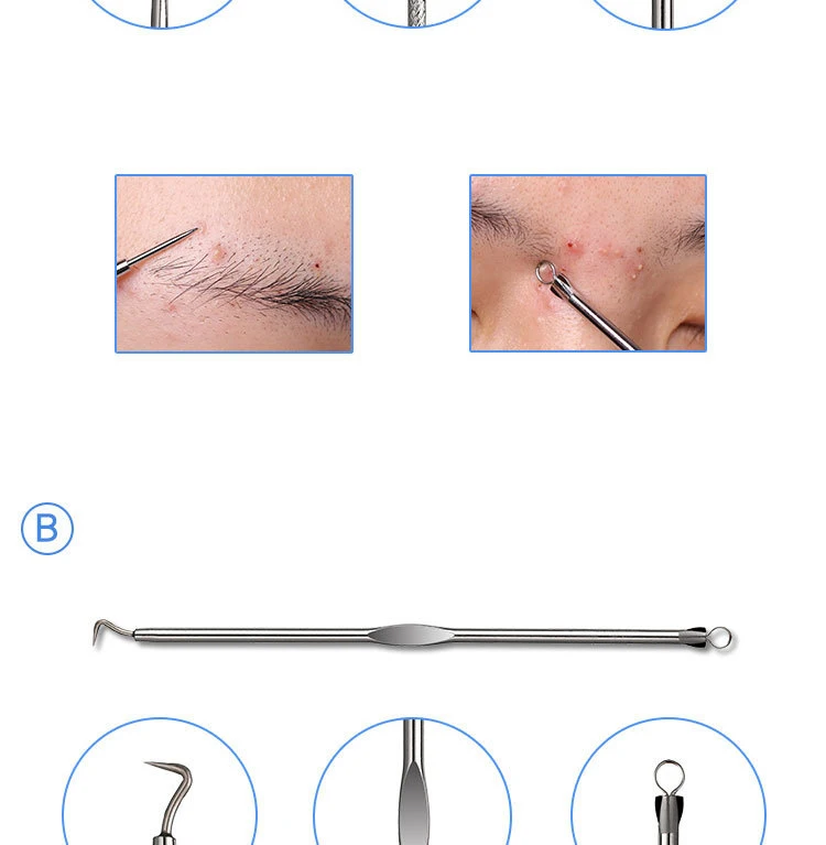 4 шт., очищающее средство против черных точек, экстрактор комедона, очищающее средство против прыщей, удаления угрей, набор игл для удаления черных точек, инструмент для удаления пор