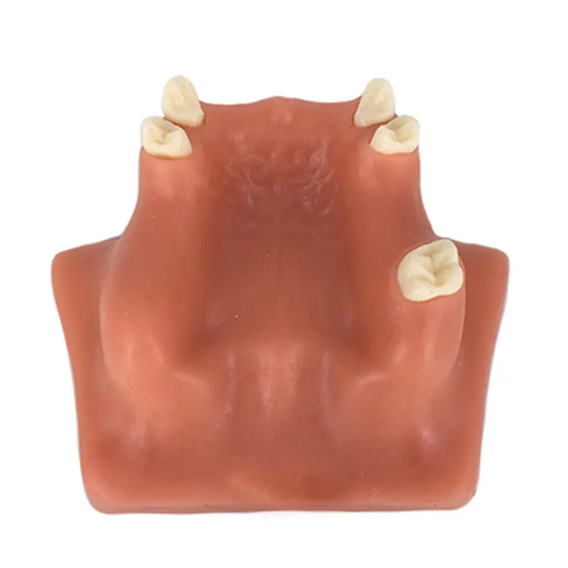 

Dental Maxillary Teeth Model Upper Jaw Sinus Lift Implants Restoration Tooth Practice Model For Medical Teach Study Demostration