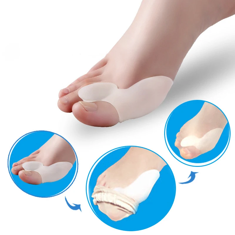 KONGDY 2 Pairs=4 Pieces Bunion Corrector Silicone Gel Toe Corrector Hallux Valgus Thumb Guard Foot Pain Relieve Patch