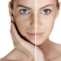 KONGDY Nieuwe Collectie 30 Patches Body Whitening Patch Glutathion Huid Fleuren Huidskleur Anti-Aging Verminderen Dark