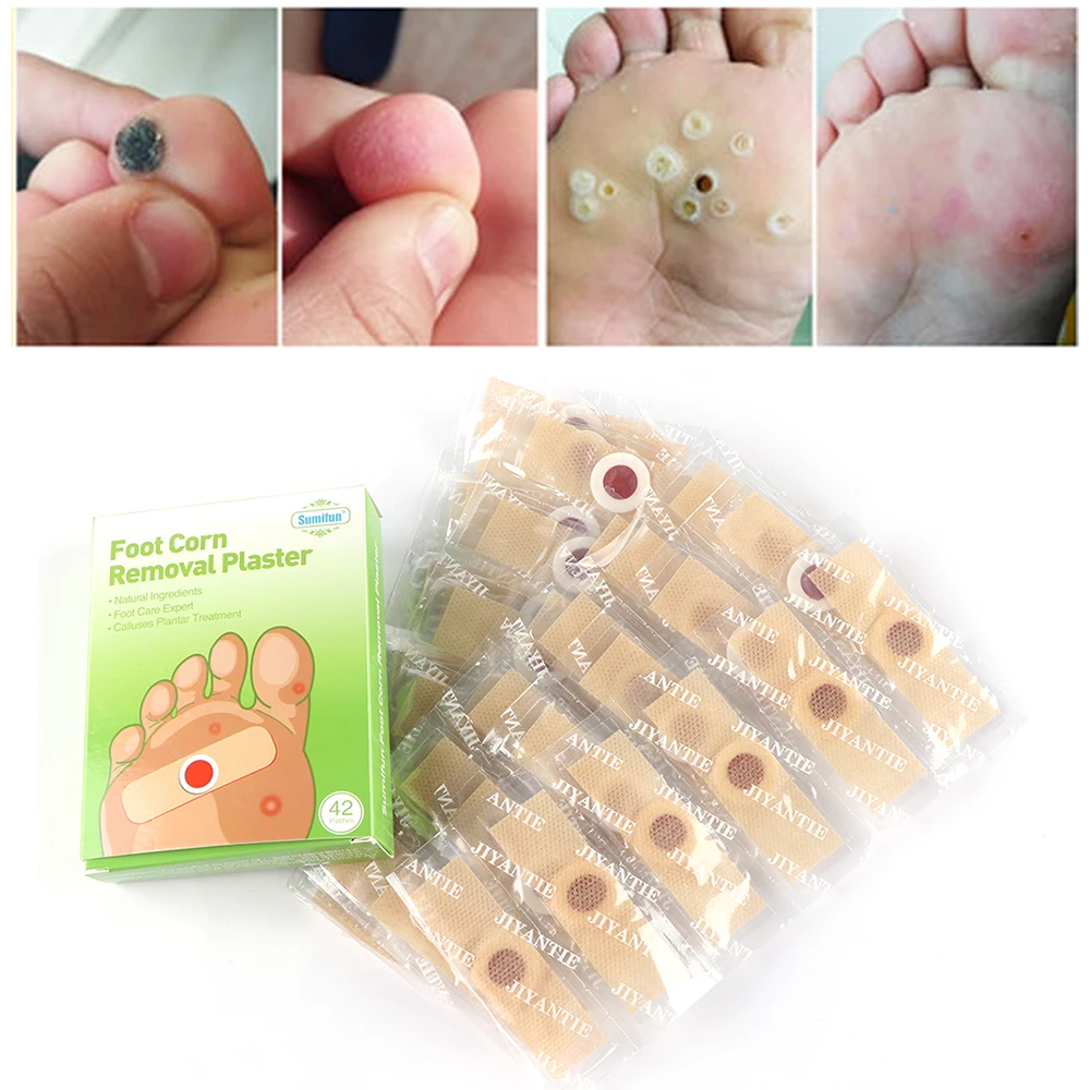 foot corn removal
