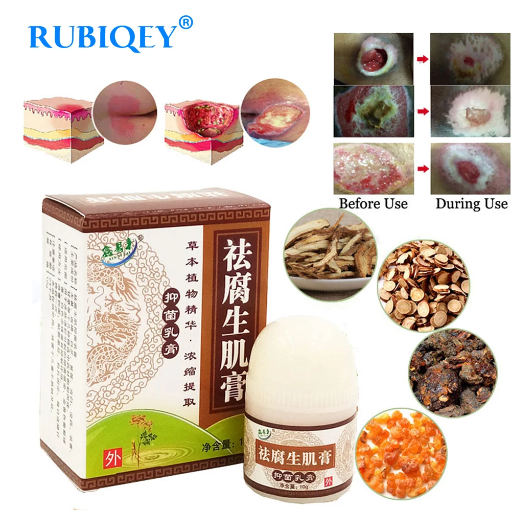 

1PC Herbal Removal Rot Myogenic Cream Bedsores Paste Treat Pressure Sores/Decubituses/Pressure Ulcer Festering Wound Healing