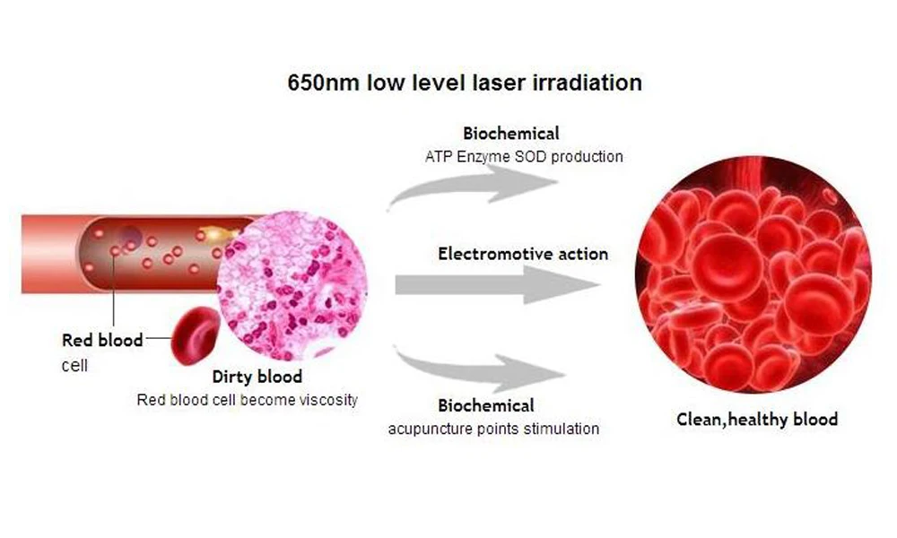 LASTEK-diabetes-machine-low-level-laser-therapy-wrist-watch-blood-pressure (7)