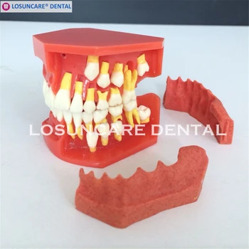 

Dental Tooth Teaching Model Children Permanent Tooth Alternative Model Deciduous Teeth Removable Demonstration For Kids Studying