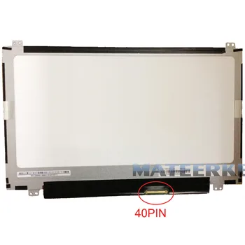 

11.6" LAPTOP LCD SCREEN FOR ACER ASPIRE ONE 725 722 TOP BRACEKTS 40PIN