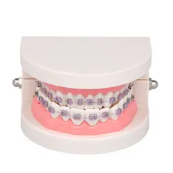 Модель зуба обучающая стандартная стоматологический ортодонтический Mallocclusion модель с кронштейнами Archwire Buccal трубка для взрослых модель