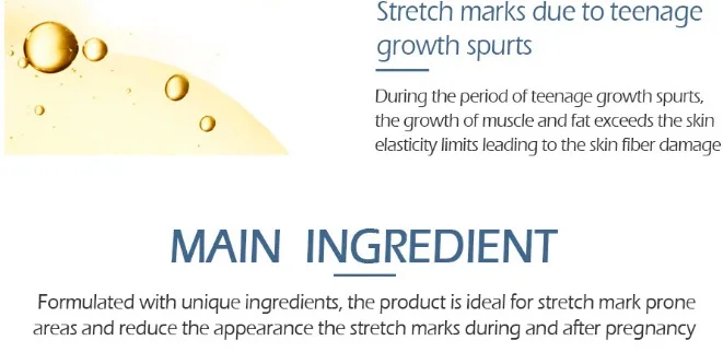 Высококачественный Гладкий крем для кожи Для Удаления растяжек и шрамов для восстановления кожи тела, крем для удаления шрамов после родов
