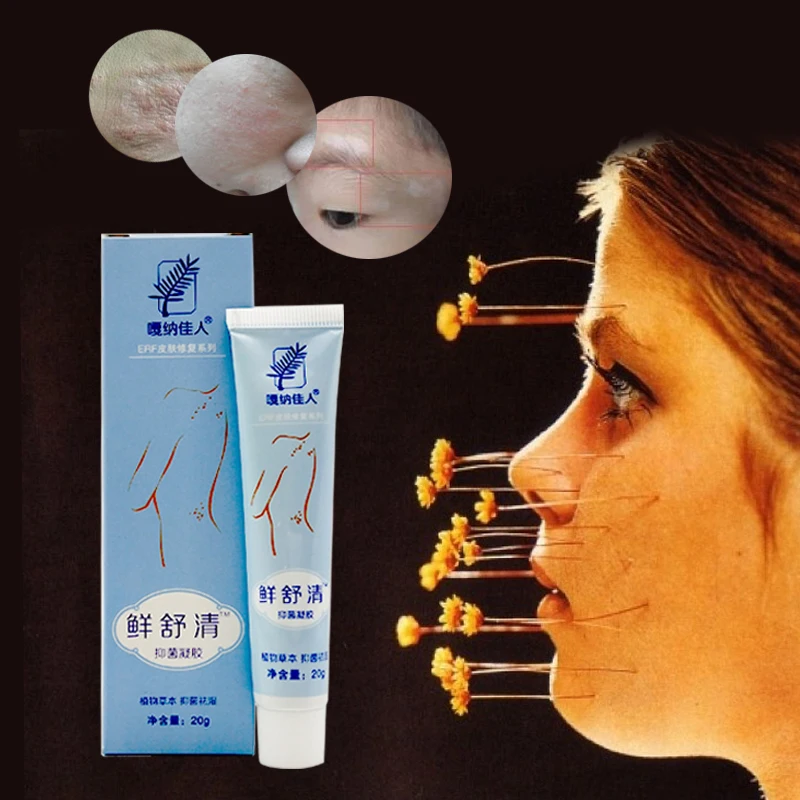 Body Psoriasis Dermatitis And Eczema Pruritus Psoriasis Skin Problems China Herbal Bacteriostatic Gel Psoriasis Creams Body Psoriasis Dermatitis And Eczema Pruritus Psoriasis Skin Problems China Herbal Bacteriostatic Gel Psoriasis Creams