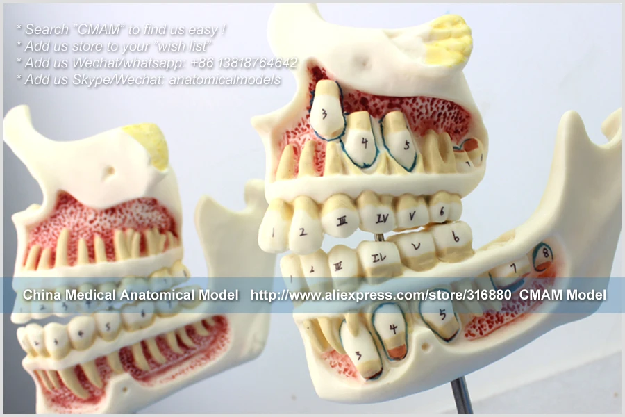 CMAM/12604 Dental-Development of the set of Teeth, Human Oral Dental медицинская обучающая анатомическая модель