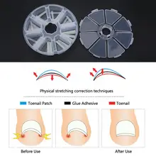 120 шт./кор. вросшие ногти Педикюр ног "францзуский маникюр" для выпрямления волос с перемычкой для большого пальца ногтей Стикеры патч вросшие ногти паронихии гвозди коррекции лечение инструмент