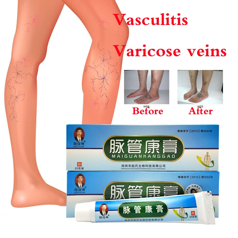 

10pack Varicosity Medical Varicose Veins Cream Treatment Anti Foot Leg Vasculitis Phlebitis Herbal Product Medical Plaster
