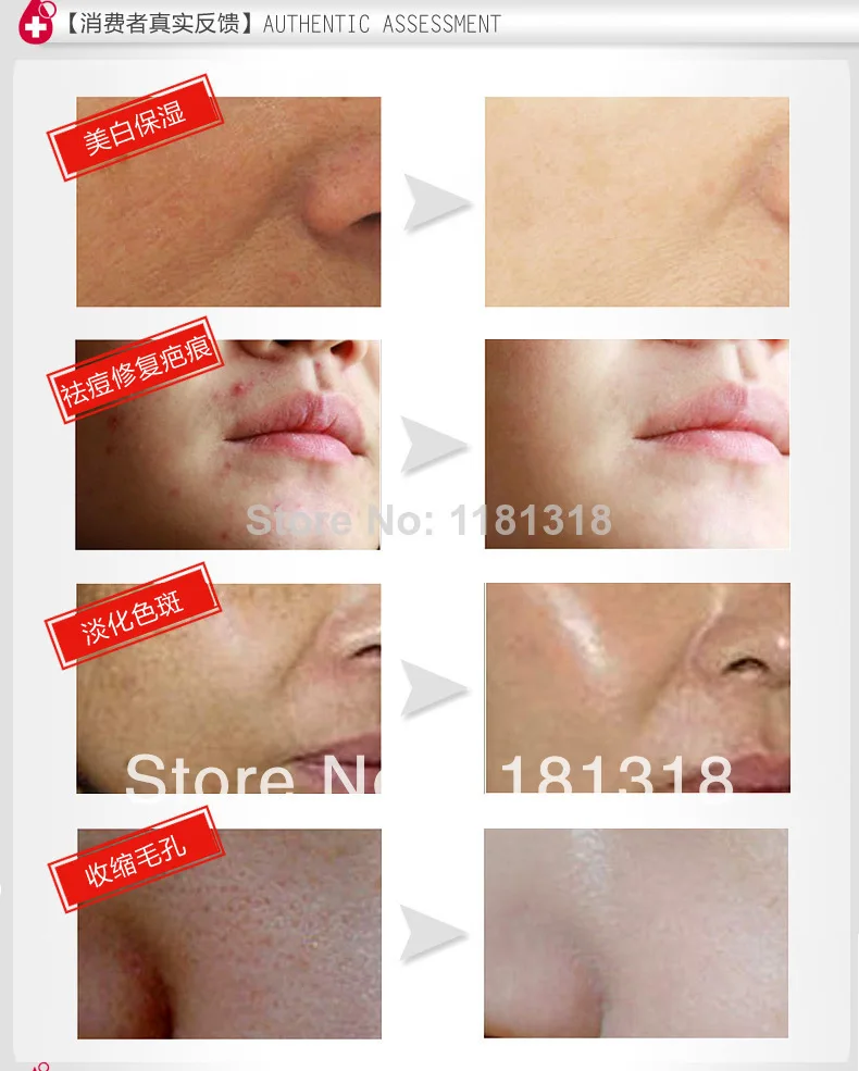 snail cream for scars
