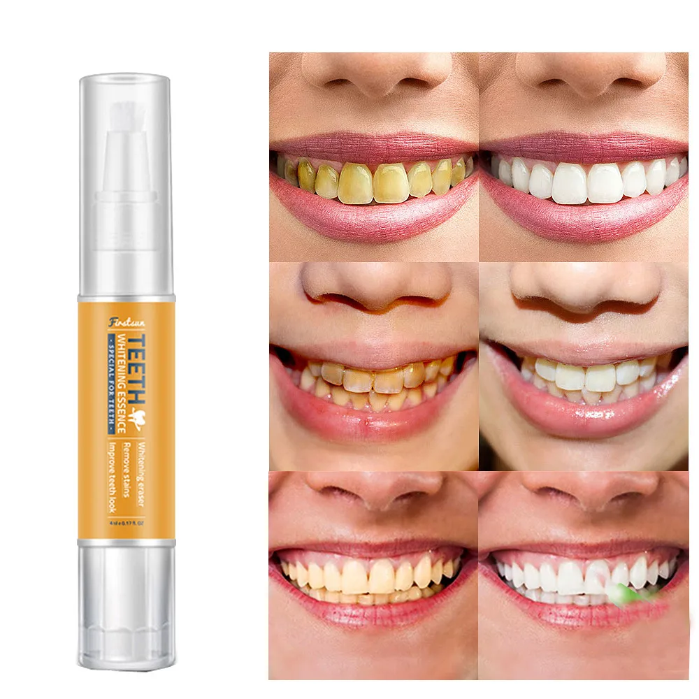 

Beauty blogger recommended White Tooth Cleaning Bleaching Dental Professional Kit Teeth White Gel Pen 2019 top sale products