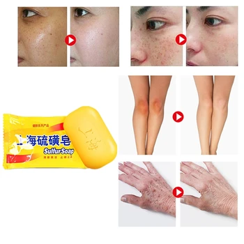 

Powerful Shanghai Sulfur Soap Acne Psoriasis Seborrhea Mite Health Beauty Care Soap 0 shipping fee