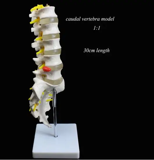 医療使用教育腰椎天然1-1大人尾vertabraモデル整形外科モデルウンバール椎間板ヘルニアモデル30センチメートル