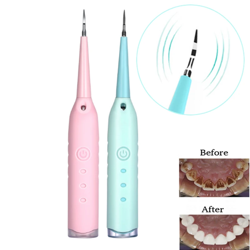 Teeth whitening High Frequency Vibration Home Use Tooth Stain Remover