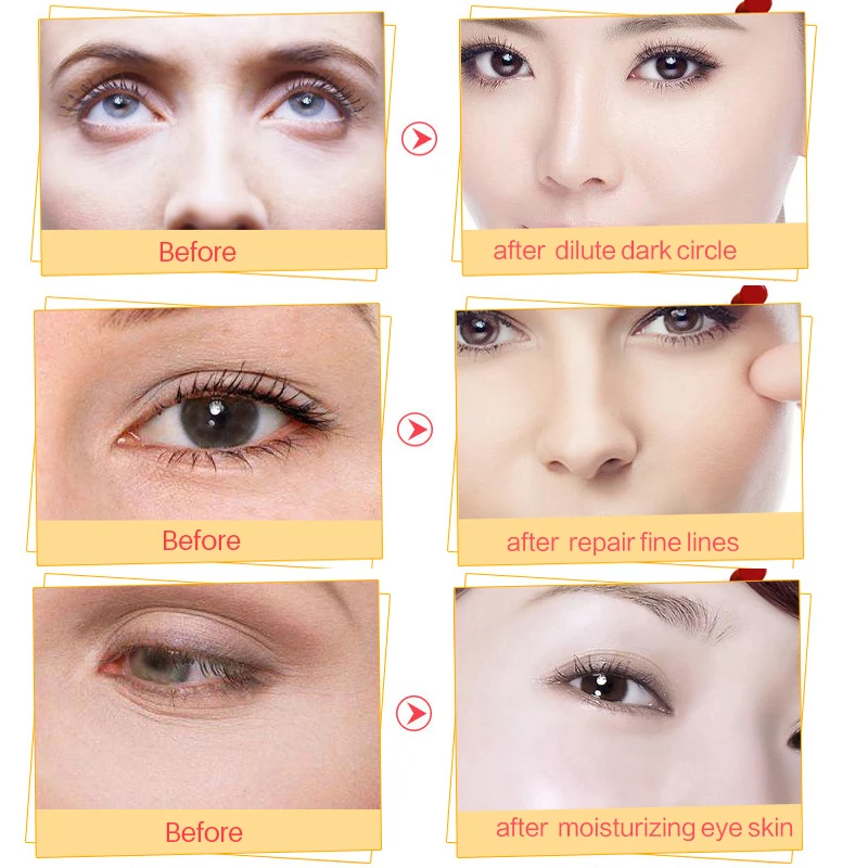 Murah 5 Bags lot Masker Mata Patch untuk Mata Anti Kerut Serum Masker Wajah Perawatan Wajah Kelembaban Di Bawah Mata Gelap Lingkaran remover