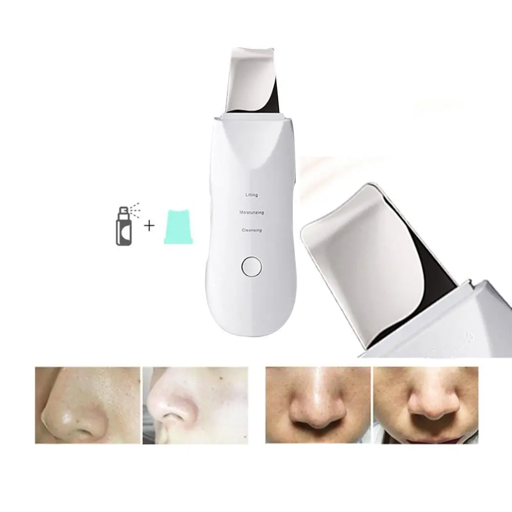 

USB Charge Beauty Instrument Blackhead Remover charging Cable Pore Unisex Acne White Casual Cleaner 150Mins Hot