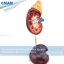 CMAM-KIDNEY05 Human Kidney with Adrenal Gland Anatomical Model, Medical Science Educational Teaching Anatomical Models
