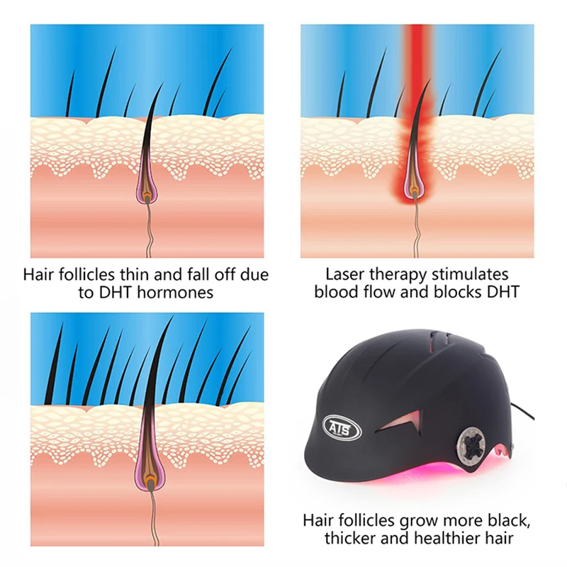 Лазерный шлем для восстановления волос, 38 медицинских диодов, лечение выпадения волос, быстрое отрастание волос, лазерная Кепка для восстановления волос, бесплатное стекло