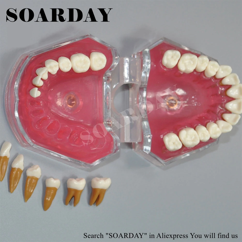 SOARDAY Стоматологическая стандартная модель зуб Съемные мягкие десны Стоматологическое обучение Стоматологическая коммуникационная модель