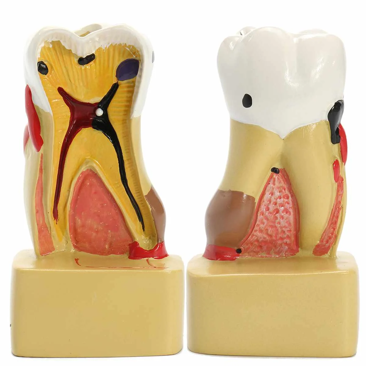 Стоматологическая Анатомия образование зубы модель 6 раз кариес компаративное исследование модели для дантиста исследования медицинской