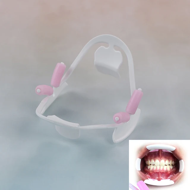 1pc mouth opener 3D Oral Dental Mouth Opener Intraoral Cheek Lip