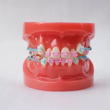 

24pcs Teeth all ceramic bracket Orthodontics Dental Model