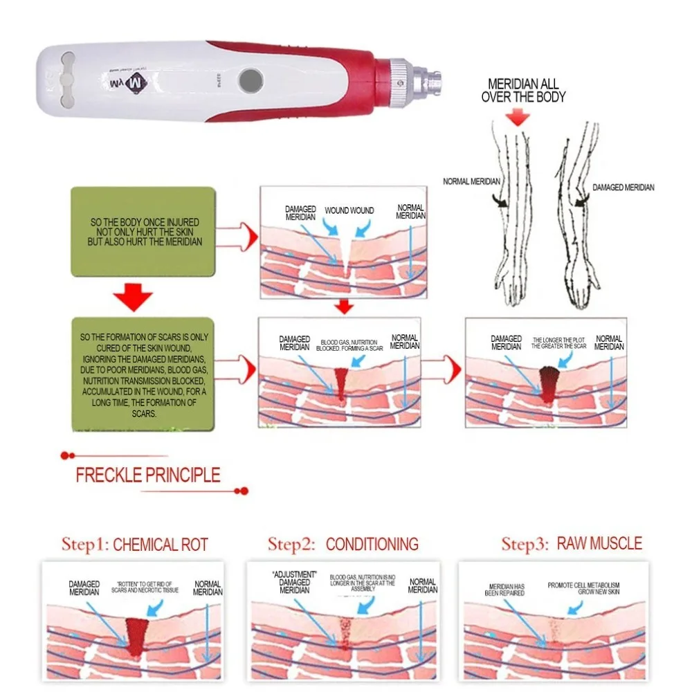 Электрическая ручка Derma Stramp, автоматический мезороллер, антивозрастная терапия кожи для лечения акне против морщин, поглощающая эссенцию