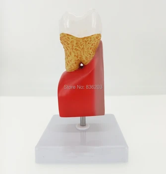 

4 times Dental caries Disease Teaching Study Medical anatomy skeleton dental anatomical brain anatomia skull