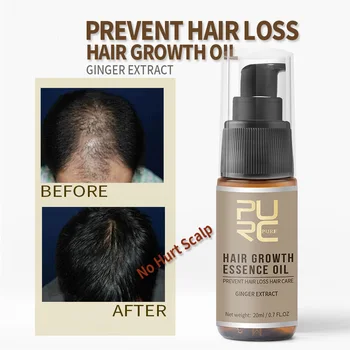 

20ml Hair Growth Essence Essential Oil With Ginger Extract Anti Hair Loss Treatment Help Roots Thick Shiny Prevent Hair Less