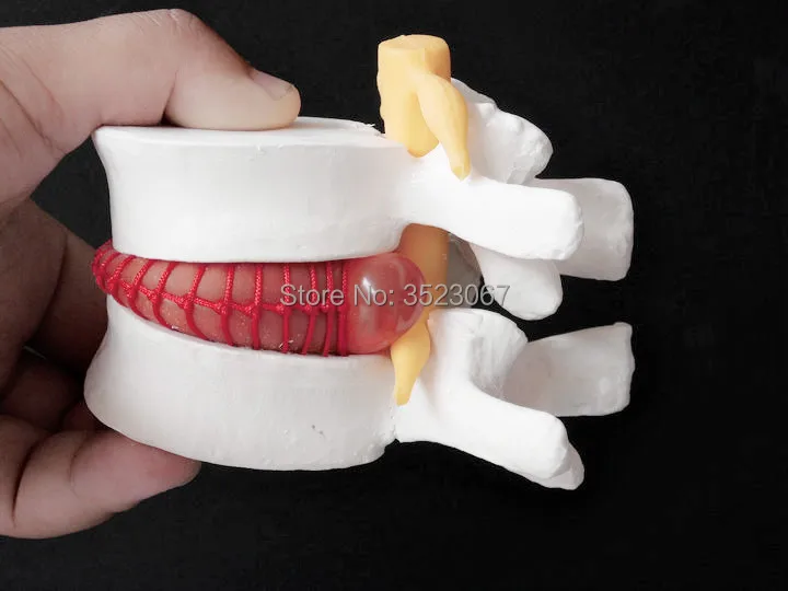 

Human anatomy skeleton Spine Lumbar Disc Herniation Teaching Model 1:1.5 skull brain skull model in trauma medical instruments