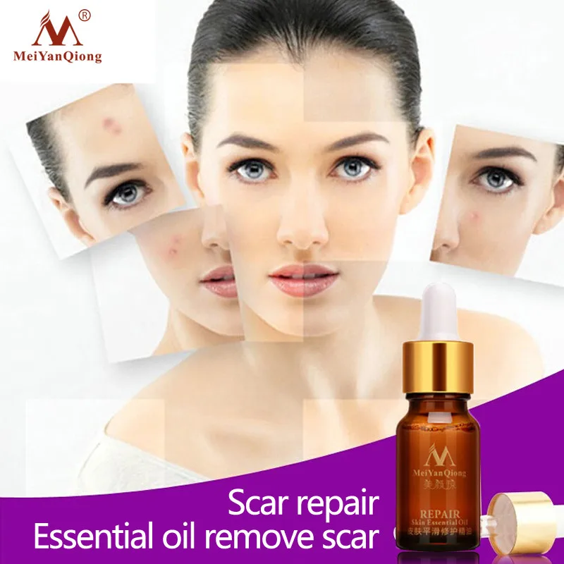 

MeiYanQiong Lavender Hyaluronic Acid Repair Skin Essential Oil Scar Ance Treatment Whitening Face Massage Body Essential Oil