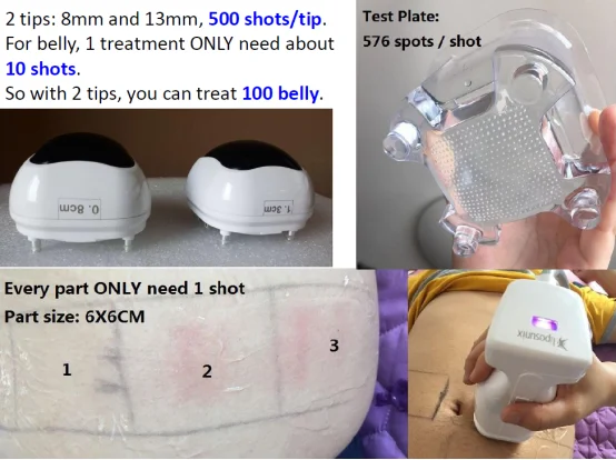 Липосоник устройство для похудения тела целлюлитный массажер liposonix удаление жира потеря веса Красота оборудование