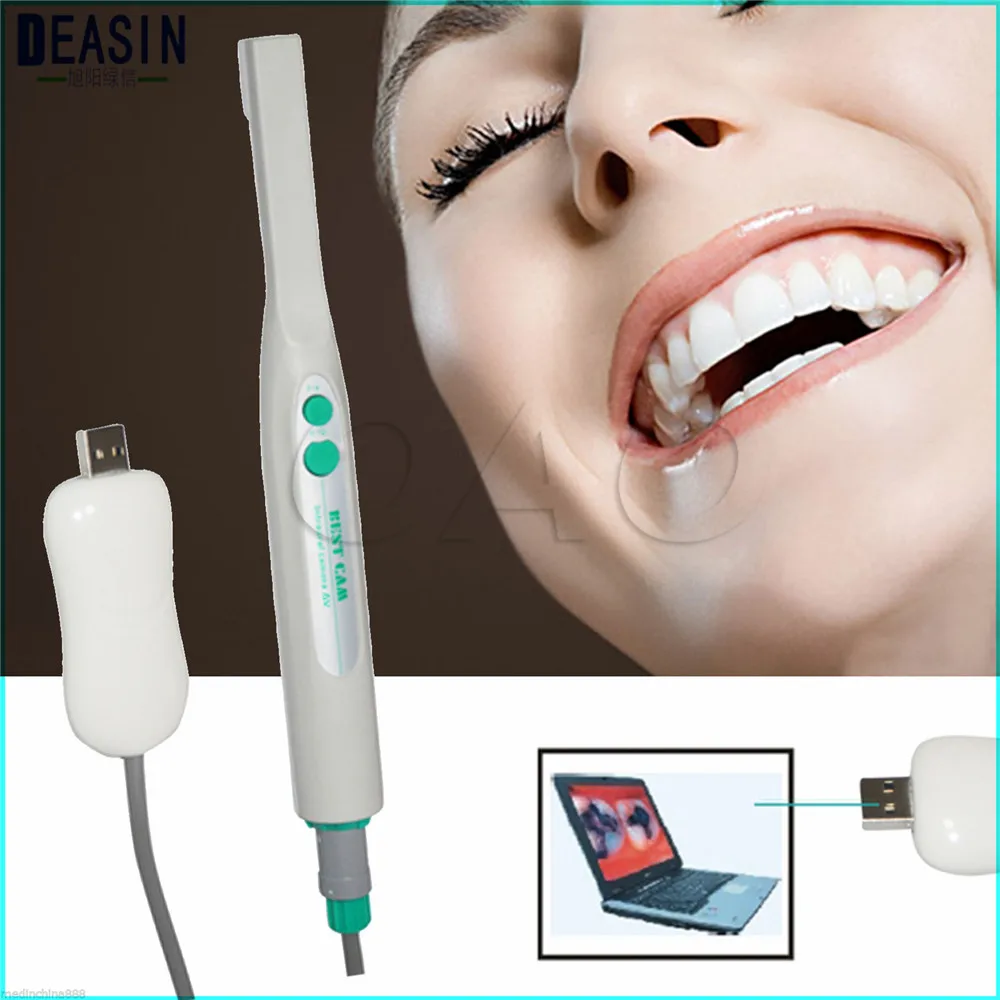 Стоматологическая intraoral камера USB изображения SONY CCD программное обеспечение
