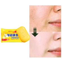 Новое медицинское обслуживание сульфатное мыло Шанхай от акне, псориаза Себорея мит здоровье Красота Уход мыло для лица и тела