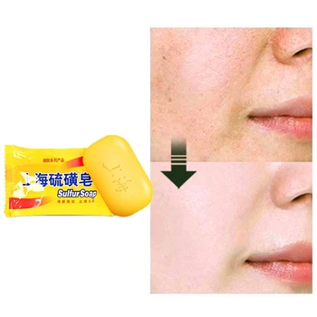 

2019 New Health Care Shanghai Sulfur Soap Acne Psoriasis Seborrhea Mite Health Beauty Care Soap For Face & Body